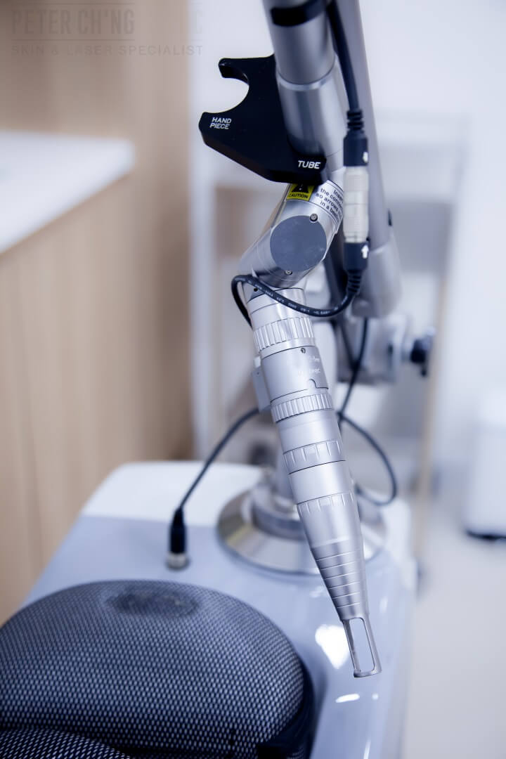 Pigment Laser Peter Ch ng Skin Specialist KL Malaysia